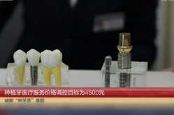 种植牙价格调控目标4500元,医疗服务调控目标定为4500元/颗